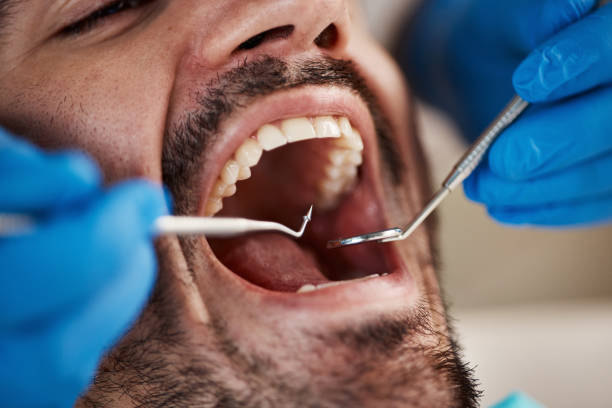Best Emergency Tooth Extraction in Berrien Springs, MI